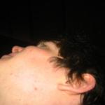 abn